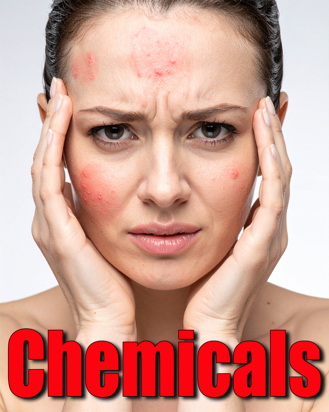 Chemicals Are Masquerading as Chronic Skin Diseases (Warning Graphic)